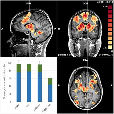 Emotion recognition in evolving facial expressions: A matter of believing